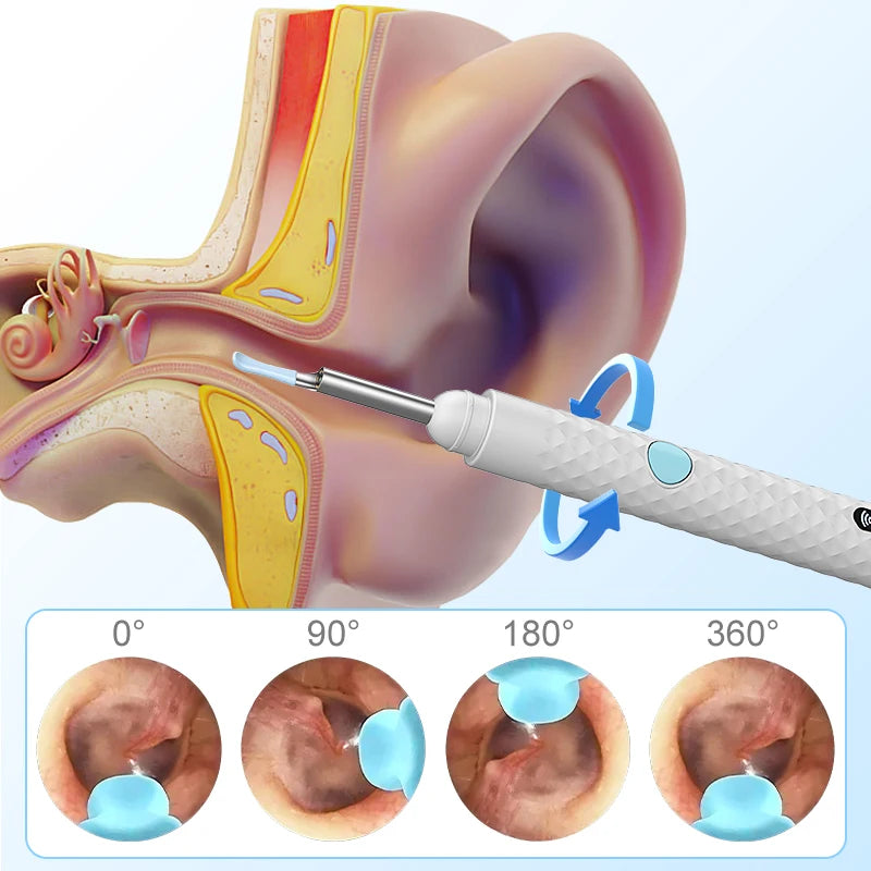 Smart Visual Ear wax Sticks